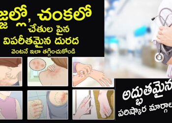 skinInfections:”పిల్లలు & స్త్రీలలో దద్దుర్లు – గజ్జి నివారణకు ఇంటి చిట్కాలు