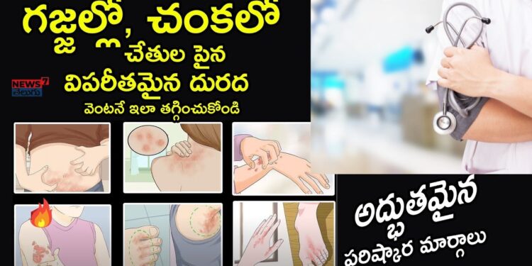 skinInfections:”పిల్లలు & స్త్రీలలో దద్దుర్లు – గజ్జి నివారణకు ఇంటి చిట్కాలు