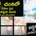 skinInfections:”పిల్లలు & స్త్రీలలో దద్దుర్లు – గజ్జి నివారణకు ఇంటి చిట్కాలు