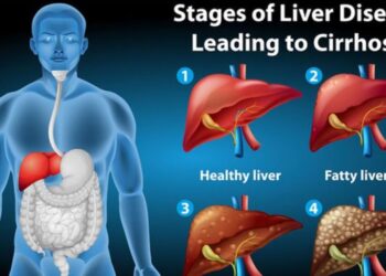 HealthyLifestyle:లివర్ సమస్యలు, లక్షణాలు మరియు ఉత్తమమైన ఆయుర్వేద నివారణ మార్గాలు