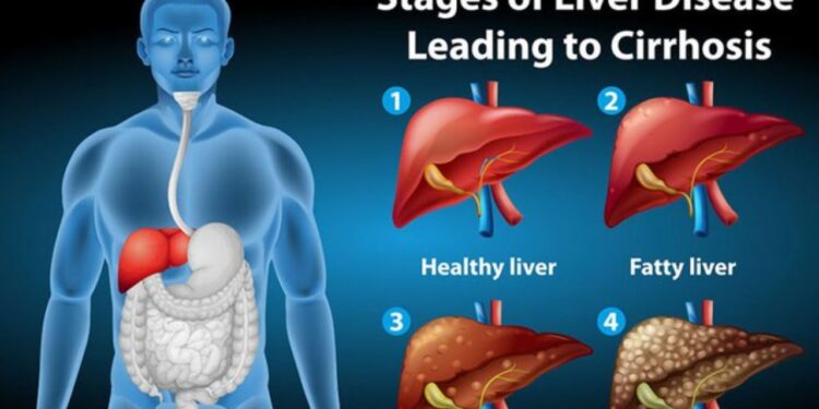 HealthyLifestyle:లివర్ సమస్యలు, లక్షణాలు మరియు ఉత్తమమైన ఆయుర్వేద నివారణ మార్గాలు