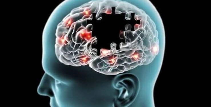 Alzheimer’s disease: అల్జీమర్స్‌ లక్షణాలు ఎలా వుంటాయంటే?